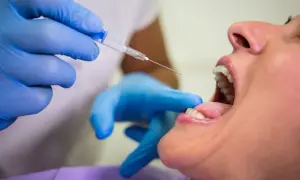 Alkohol po dentyscie: kiedy można pić? Sprawdź zalecenia