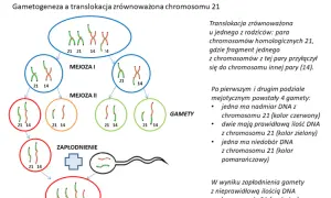 Zespół Downa: objawy, diagnoza i życie z trisomią 21