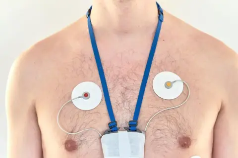 Mężczyzna z przyklejonymi elektrodami i urządzeniem na klatce piersiowej, monitorującym jego serce. To holter ciśnieniowy.