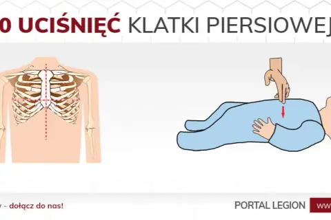 Pierwsza pomoc: ile ucisków RKO? Schemat 30:2 i inne zasady