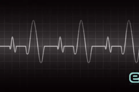 Nieregularny zapis EKG na czarnym tle. Pokazuje, jakie są objawy arytmii serca, gdy rytm jest zaburzony.