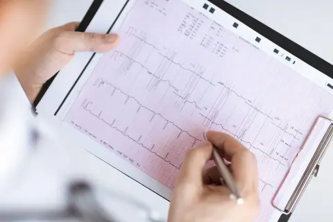 Ręka z długopisem wskazuje na zapis EKG, pomagając zrozumieć, jak odczytać wynik ekg.