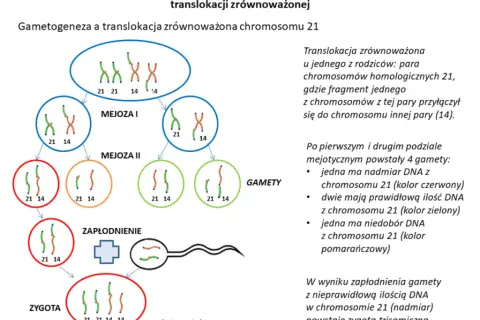Zespół Downa: objawy, diagnoza i życie z trisomią 21