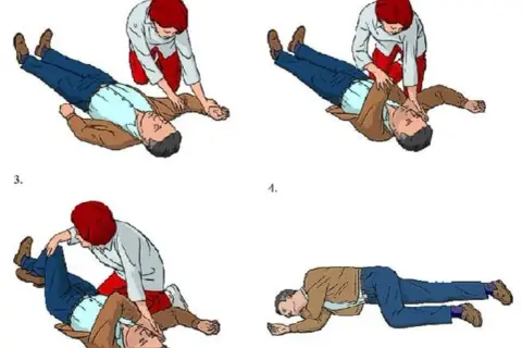 Pozycja boczna bezpieczna: co ile zmieniać stronę? Odpowiadamy