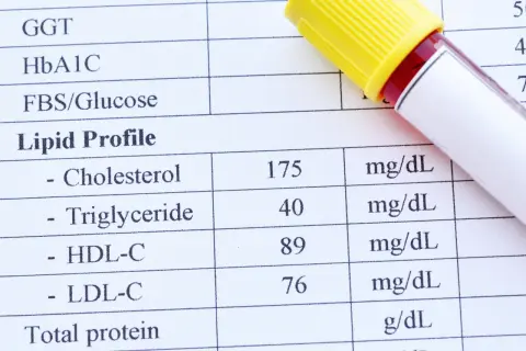 Wyniki lipidogramu: cholesterol 175 mg/dL, triglicerydy 40 mg/dL, HDL-C 89 mg/dL, LDL-C 76 mg/dL. Jak interpretować wyniki cholesterolu?