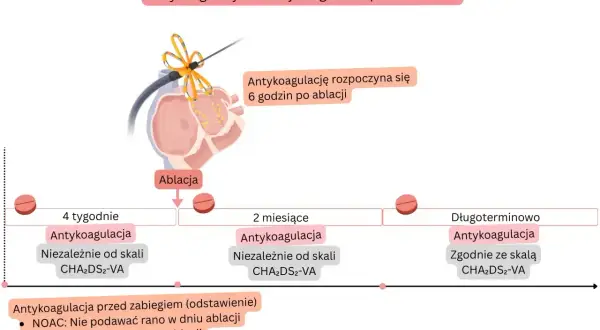 Schemat antykoagulacji po ablacji migotania przedsionków. Nowy lek na migotanie przedsionków jest kluczowy w terapii.