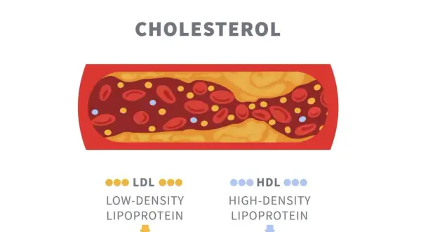 Schemat przedstawia przekrój naczynia krwionośnego z cholesterolem. Widać LDL (zły) i HDL (dobry), kluczowe dla lipidogramu normy.
