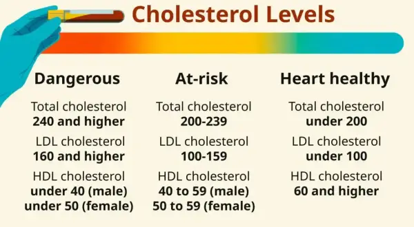 Tabela przedstawia poziomy cholesterolu: niebezpieczne, podwyższonego ryzyka i zdrowe dla serca. Kluczowe dla profilu lipidowego.