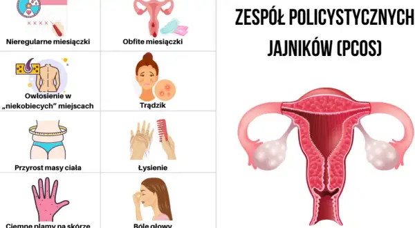 Zespół policystycznych jajników: Objawy, diagnoza i jak sobie z nim radzić