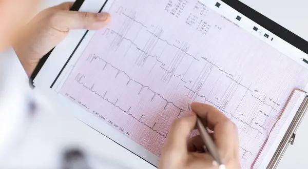 Ręka z długopisem wskazuje na zapis EKG, pomagając zrozumieć, jak odczytać wynik ekg.