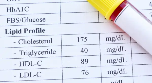 Wyniki lipidogramu: cholesterol 175 mg/dL, triglicerydy 40 mg/dL, HDL-C 89 mg/dL, LDL-C 76 mg/dL. Jak interpretować wyniki cholesterolu?