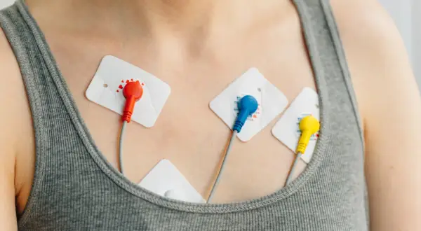 Elektrody EKG na klatce piersiowej, monitorujące pracę serca pod kątem arytmii.