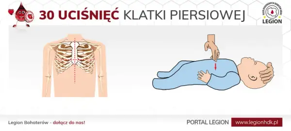 Pierwsza pomoc: ile ucisków RKO? Schemat 30:2 i inne zasady