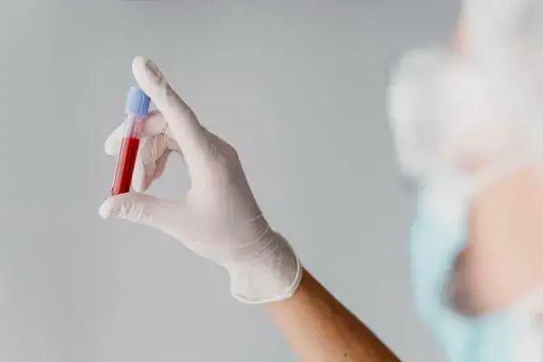 Alkohol przed badaniem krwi? Jak długo nie pić, by wyniki były wiarygodne